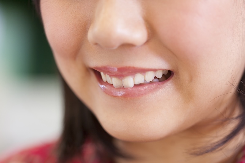 顎と歯のバランス